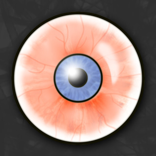 c3 c3 painful red eye conjunctiva sclera em rap conjunctiva