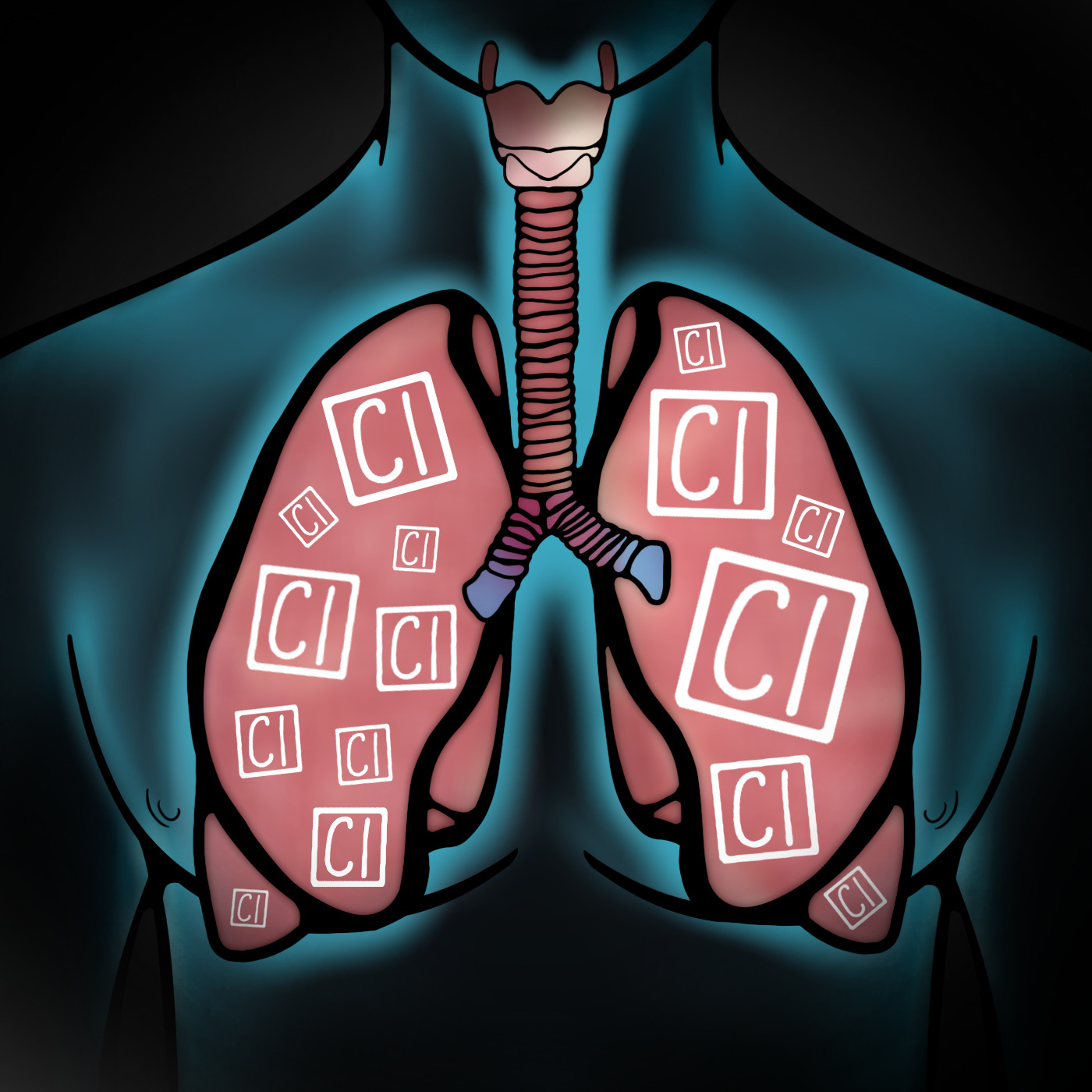 February 2018 Chlorine Gas Inhalation Ready, Set, Pause... EMRAP