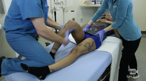 Reduction Techniques for Posterior Hip Dislocation Artwork