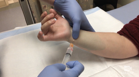Ulnar Nerve Block at the Wrist Artwork
