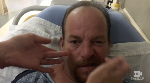 Bell's Palsy Facial Droop Artwork