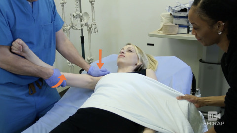 Reduction of Anterior Shoulder Dislocation Artwork