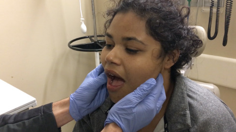 Reduction of Temporomandibular Joint Dislocation Artwork