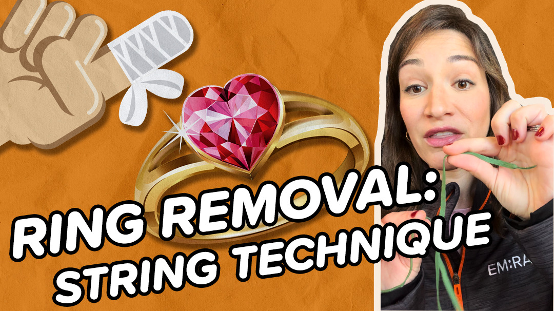 HD Ring Removal String Technique EMRAP